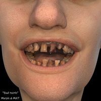 Henrika_ChrissyBundleforG9_ChrissyBadTeeth.jpg