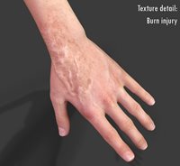 Victor_hand.jpg