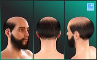lightBLUE-FullHead-01-promo3.jpg