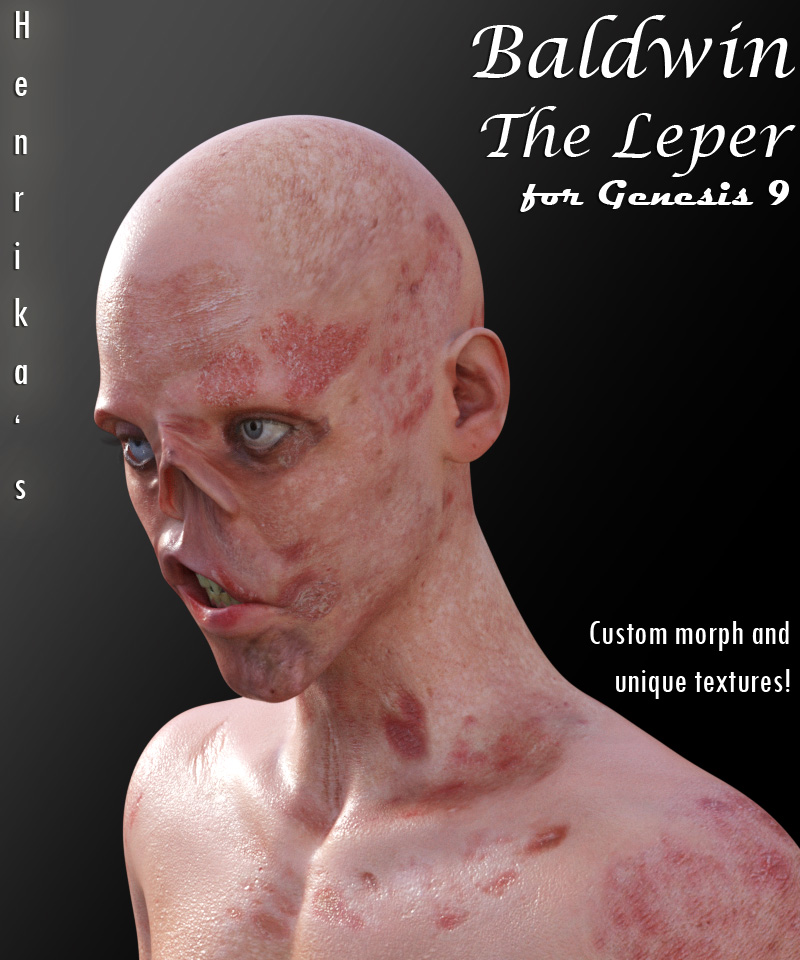 Baldwin the Leper for G9